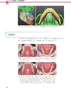 実践的リンガルブラケット矯正 実践的リンガルブラケット矯正 | 松野 功 |本 | 通販 | Amazon
