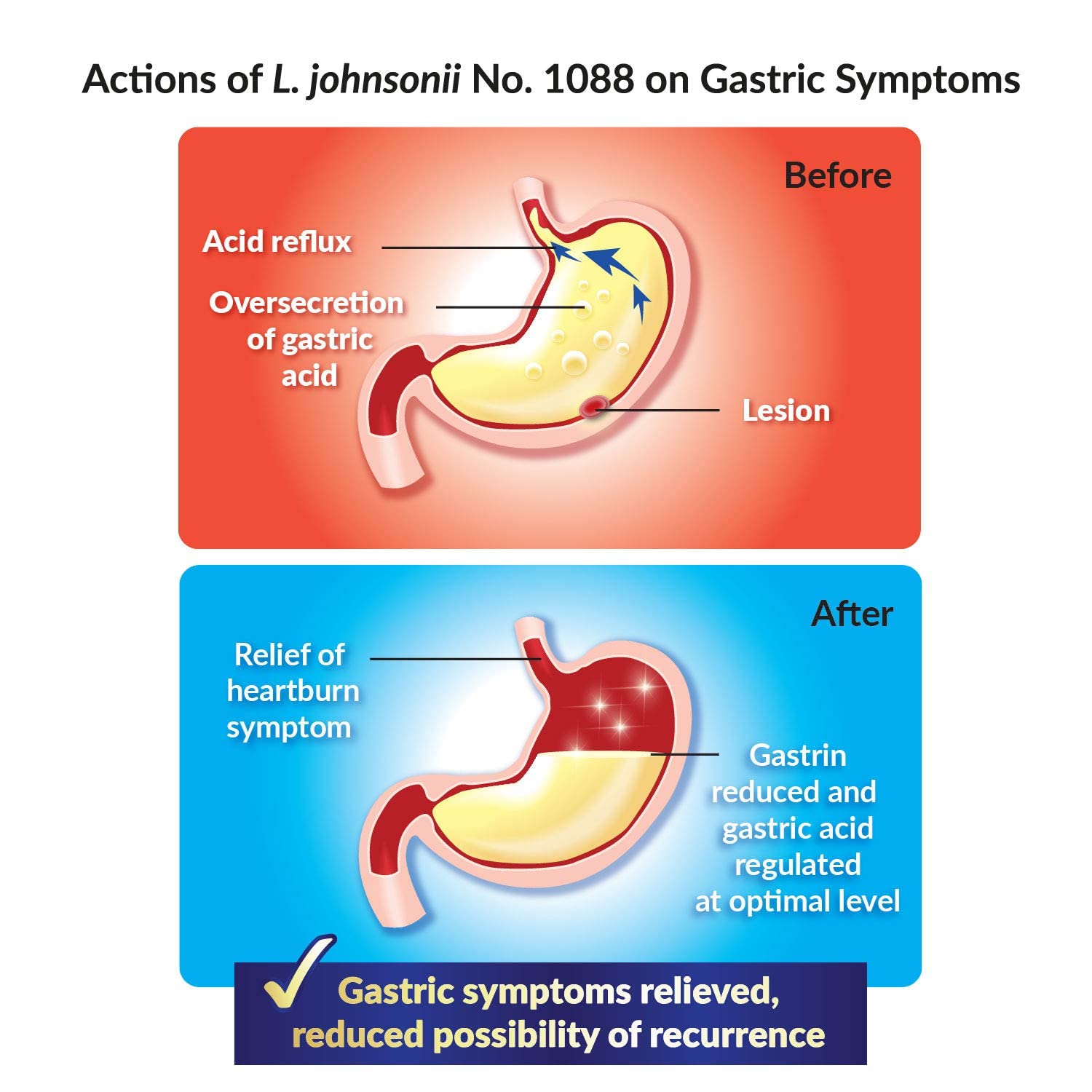 GASTRICELL Eliminate H. Pylori, Relieve Acid Reflux and Heartburn