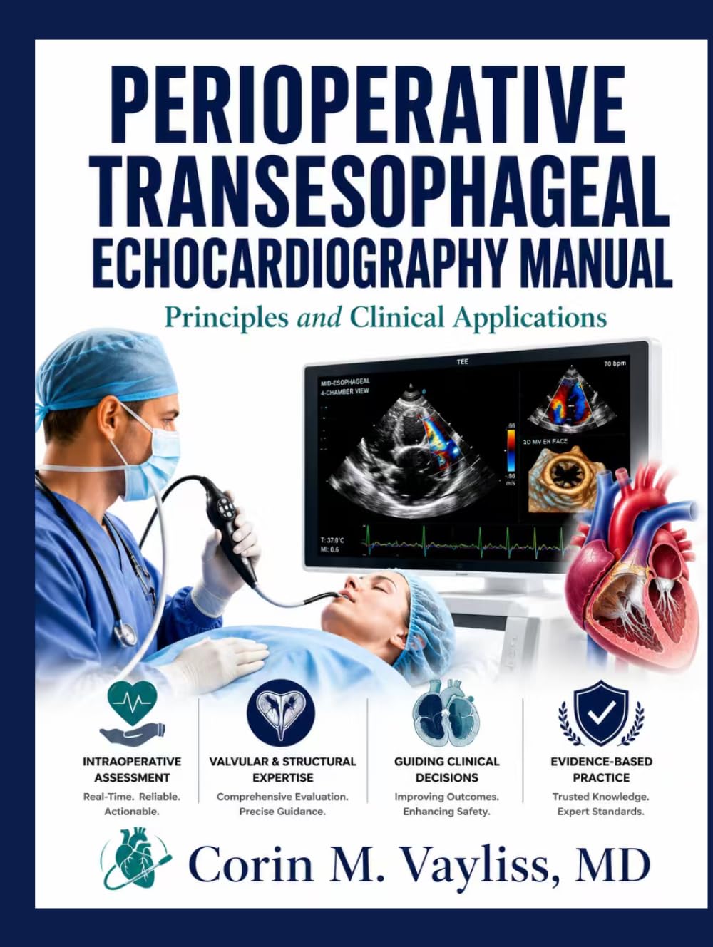 PERIOPERATIVE TRANSESOPHAGEAL ECHOCARDIOGRAPHY MANUAL: Principles and Clinical Applications