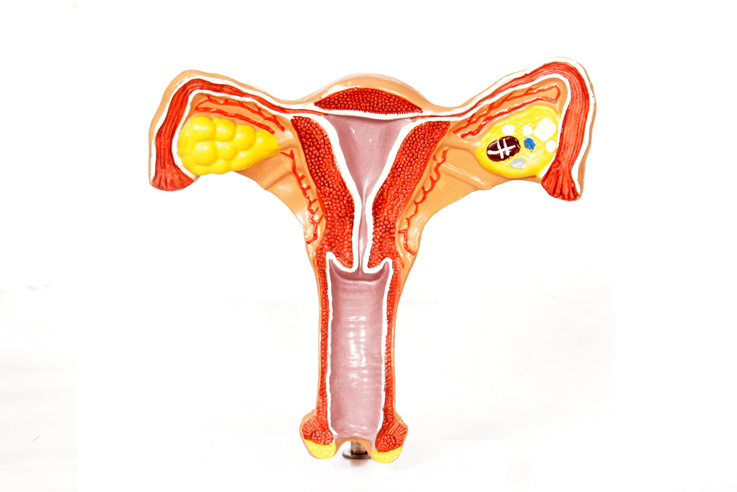 KKI Female Uterus with Ovary Reproductive System Organ Anatomical Model Perfect for Medical students and Training (B096N5B97J) Amazon Price History, Amazon Price Tracker