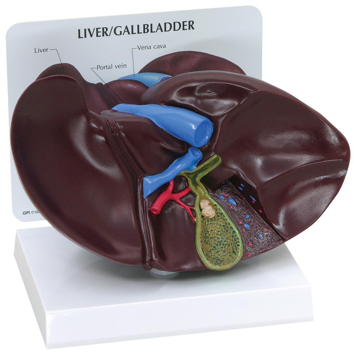 3B Scientific 1019551 Liver/Gallbladder Model with Gallstones