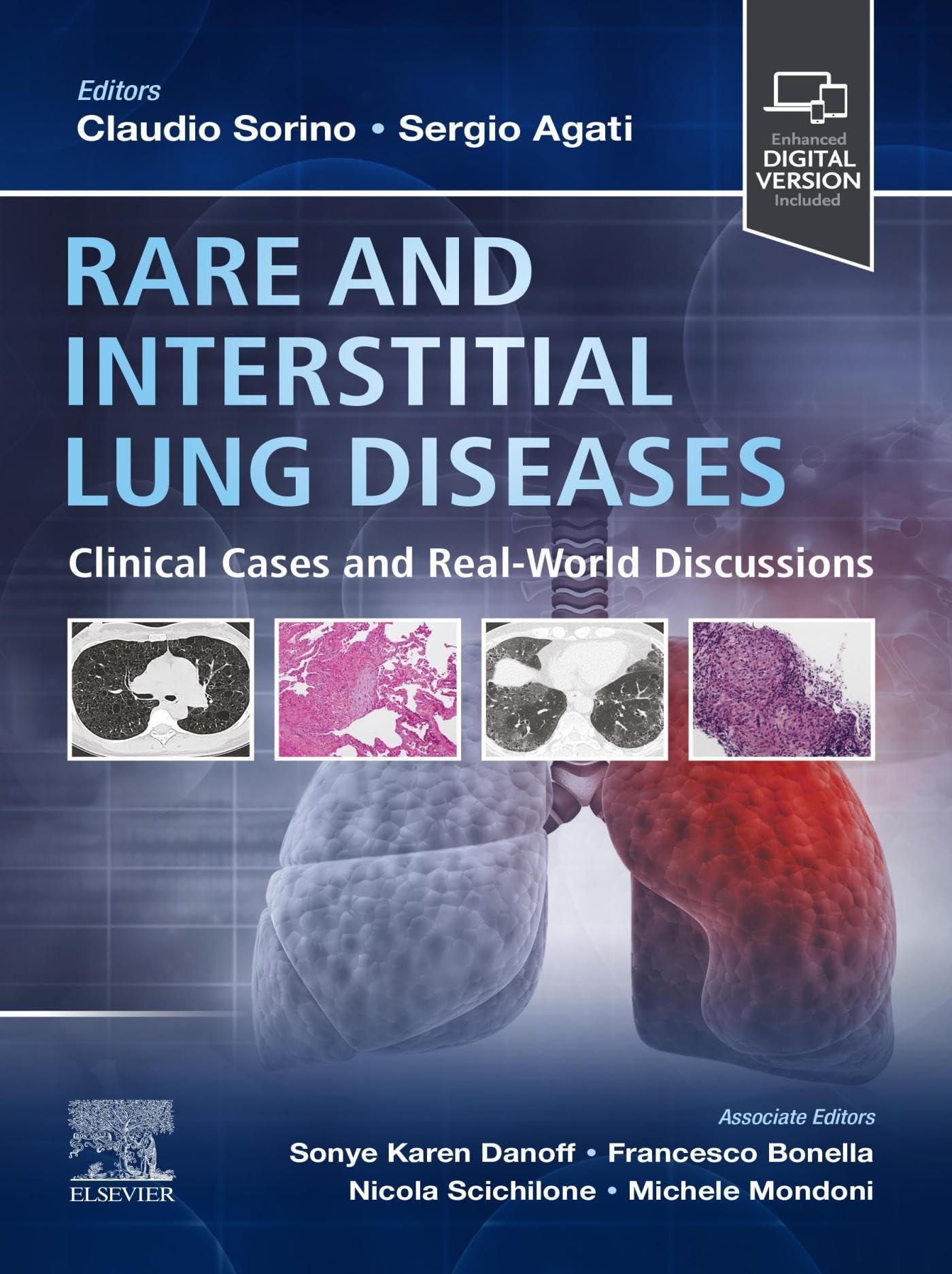 Rare and Interstitial Lung Diseases - E-Book: Clinical Cases and Real-World Discussions (English Edition)