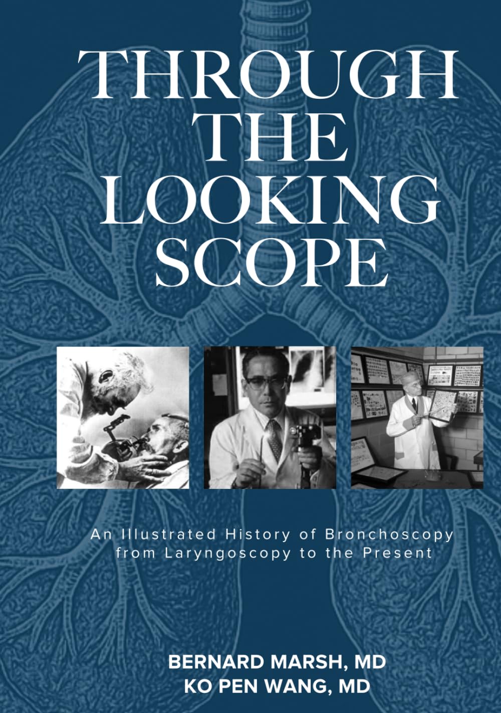 Through the Looking Scope: An Illustrated History of Bronchoscopy from Laryngoscopy to the Present      Hardcover – July 27, 2025