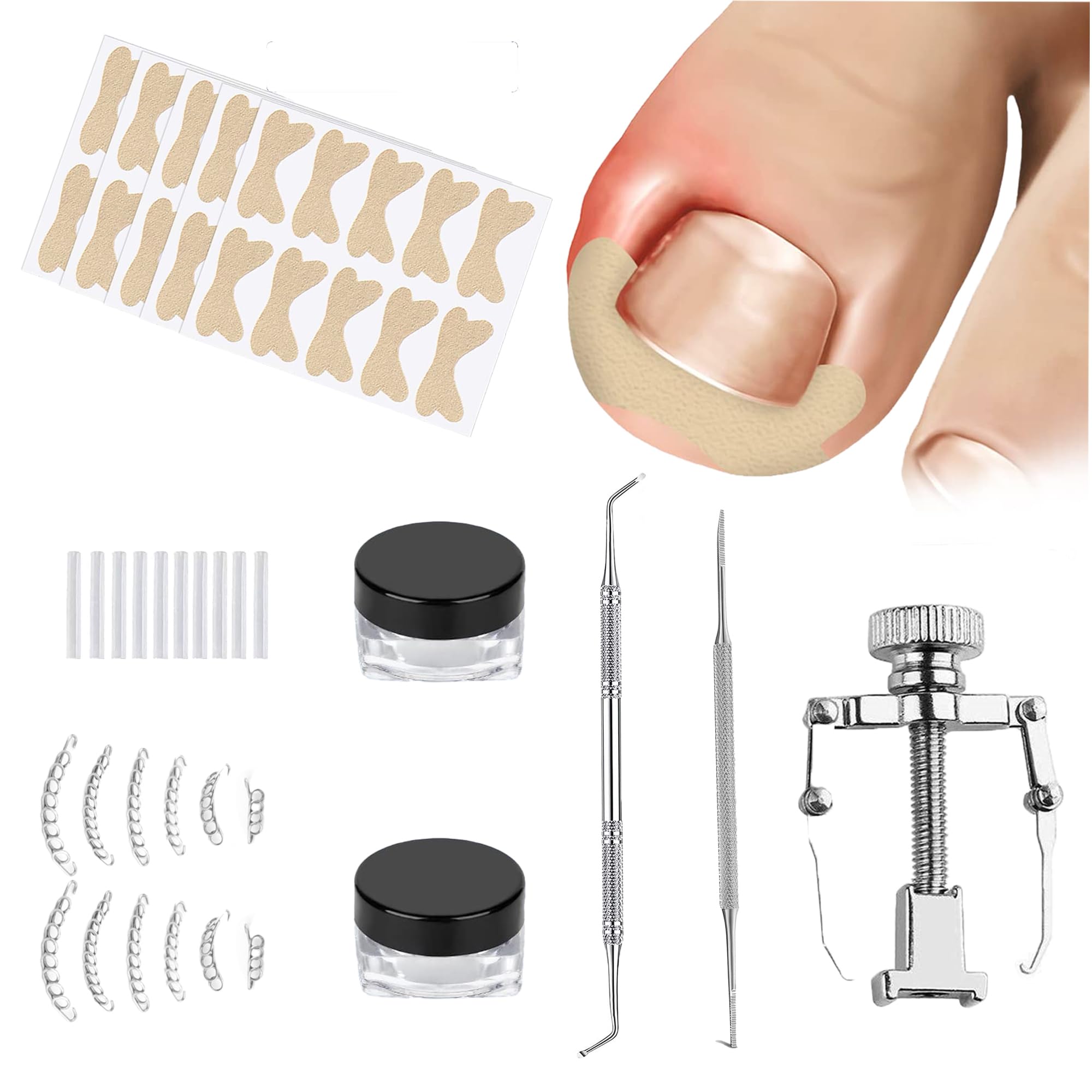 Buy Ingrown Toenail Kit, Ingrown Toenail Tool Ingrown Toenail Corrector