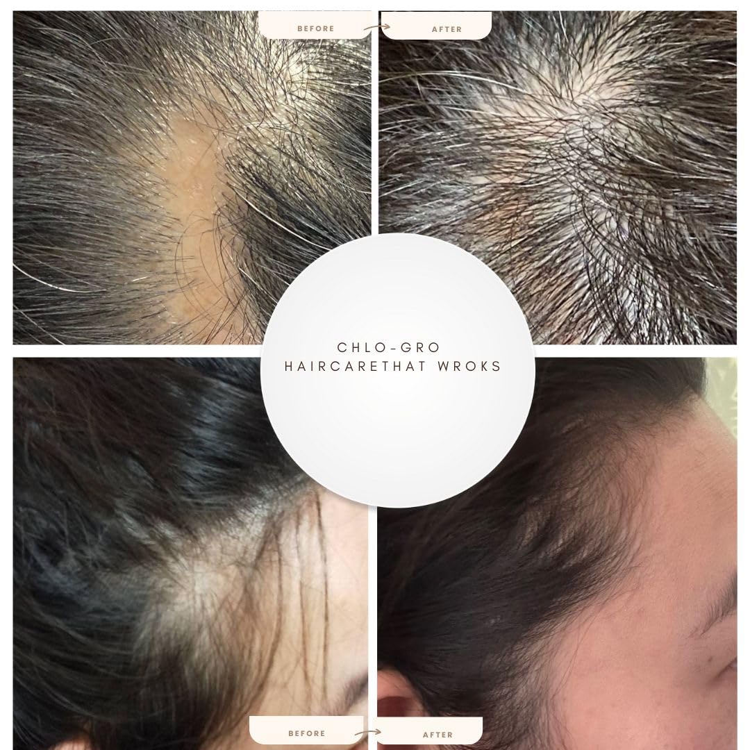 CHLO-GRO Hair Elixir, Hair Growth Serum, Promotes Thicker, Fuller Growth, Natural Scalp Serum for Men & Women with Argan Oil - Image 3