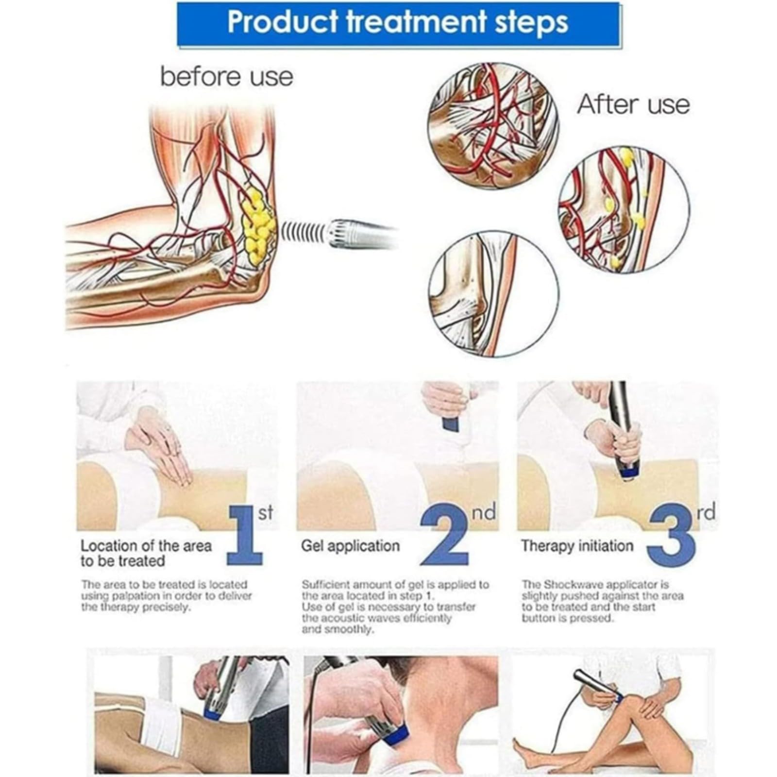 Máquina De Terapia De Ondas De Choque Instrumento De Terapia ED Portátil De Masajeador Muscular Adecuado Para El Tratamiento De La Disfunción Eréctil, Dispositivos De Relajación, Fácil De Usar