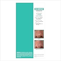 Vista 3 de Peter Thomas Roth Purificador exfoliante de poros de microdermoabrasión Even Smoother™