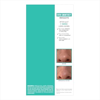 Peter Thomas Roth | Even SmootherTM Microdermabrasion Exfoliating Pore Purifier with Salicylic Acid for Oil Control