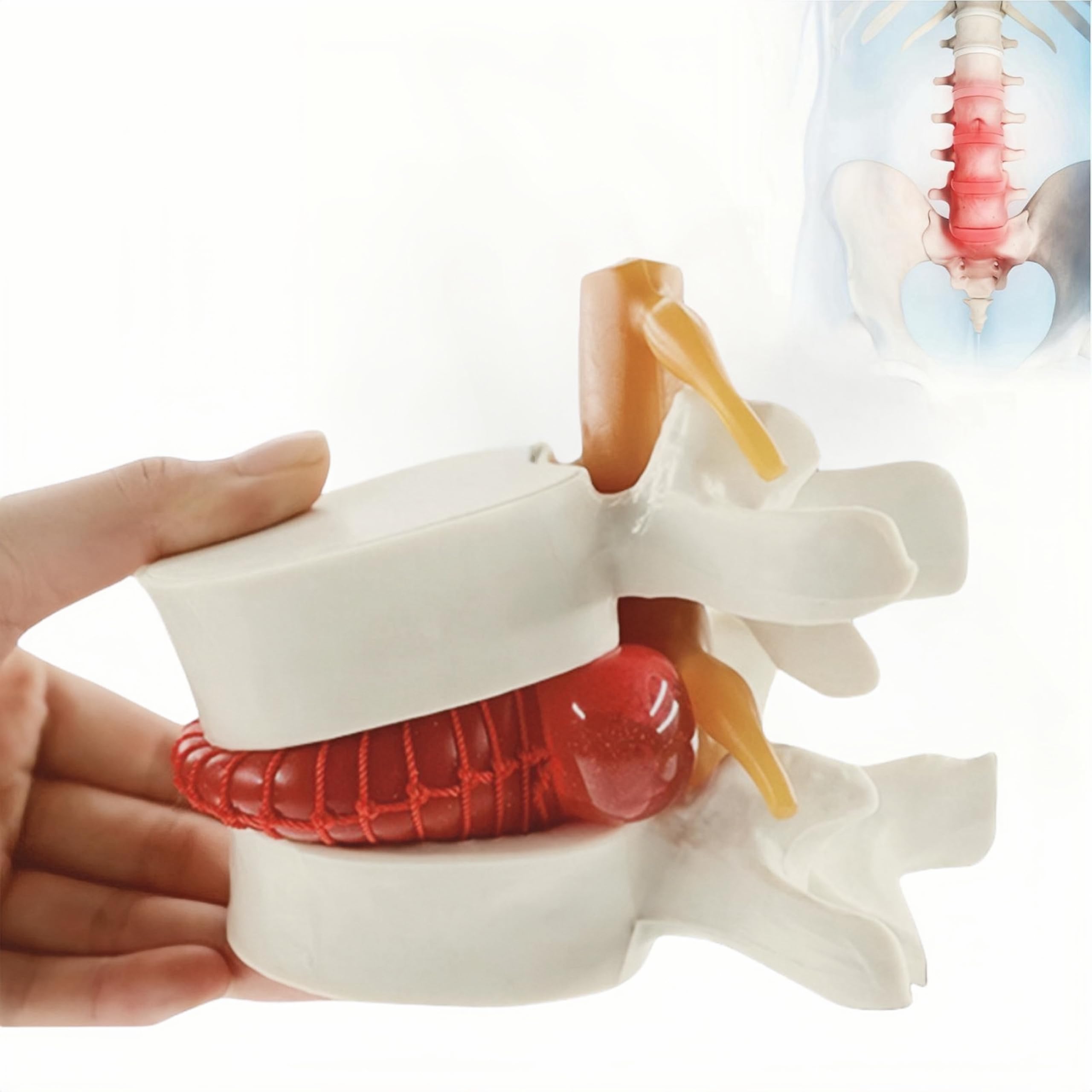 Human Anatomical Lumbar Disc Herniation Model 1.5 Times Life Size Lumbar Spine Model for Teaching and Learning (1pc Spine and Disc Model)