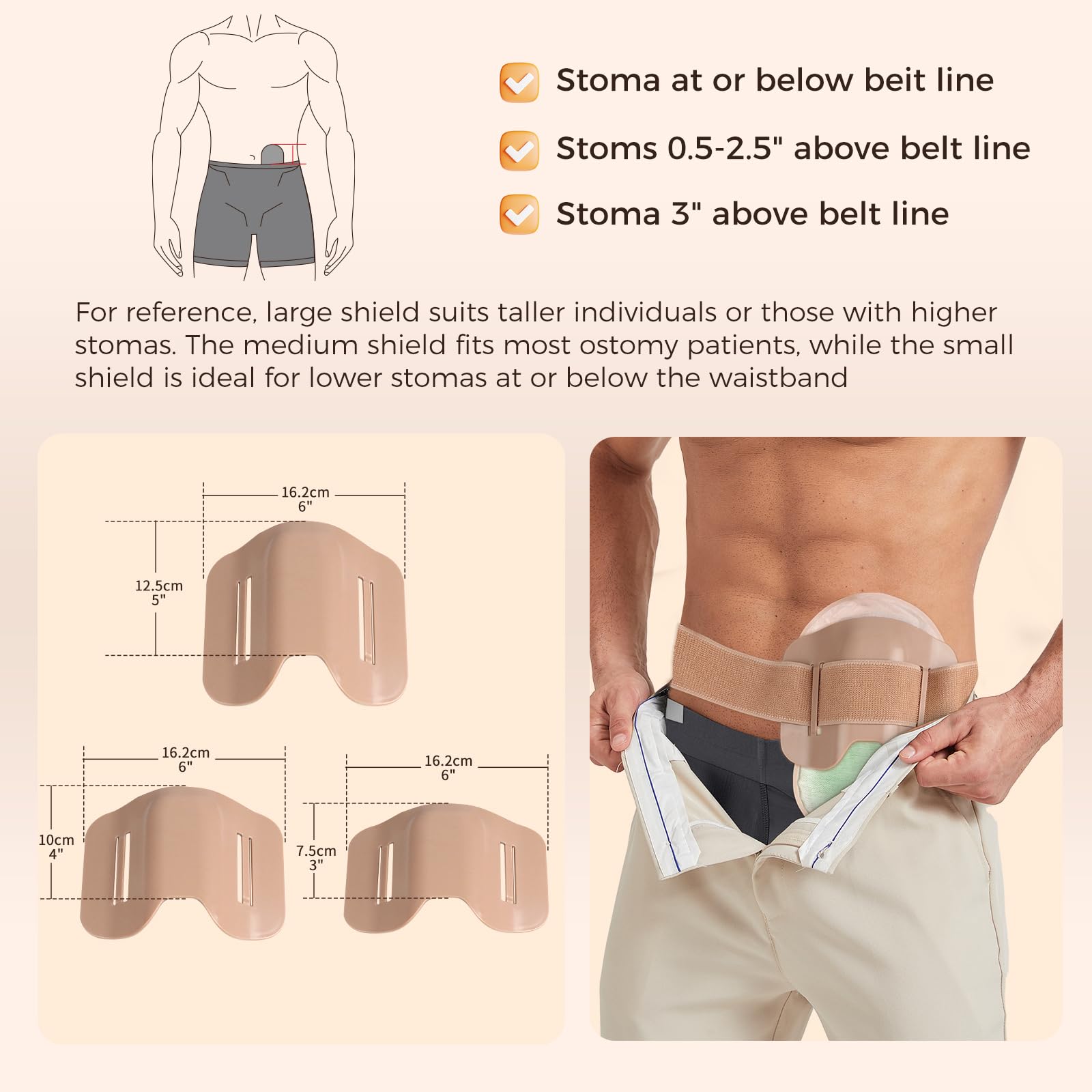 Cinturón de estoma, escudo protector de estoma, escudo anticolisión para protección deportiva y laboral, bolsa de ostomía, accesorios de estoma, cubiertas de bolsas de colostomía para mujeres y