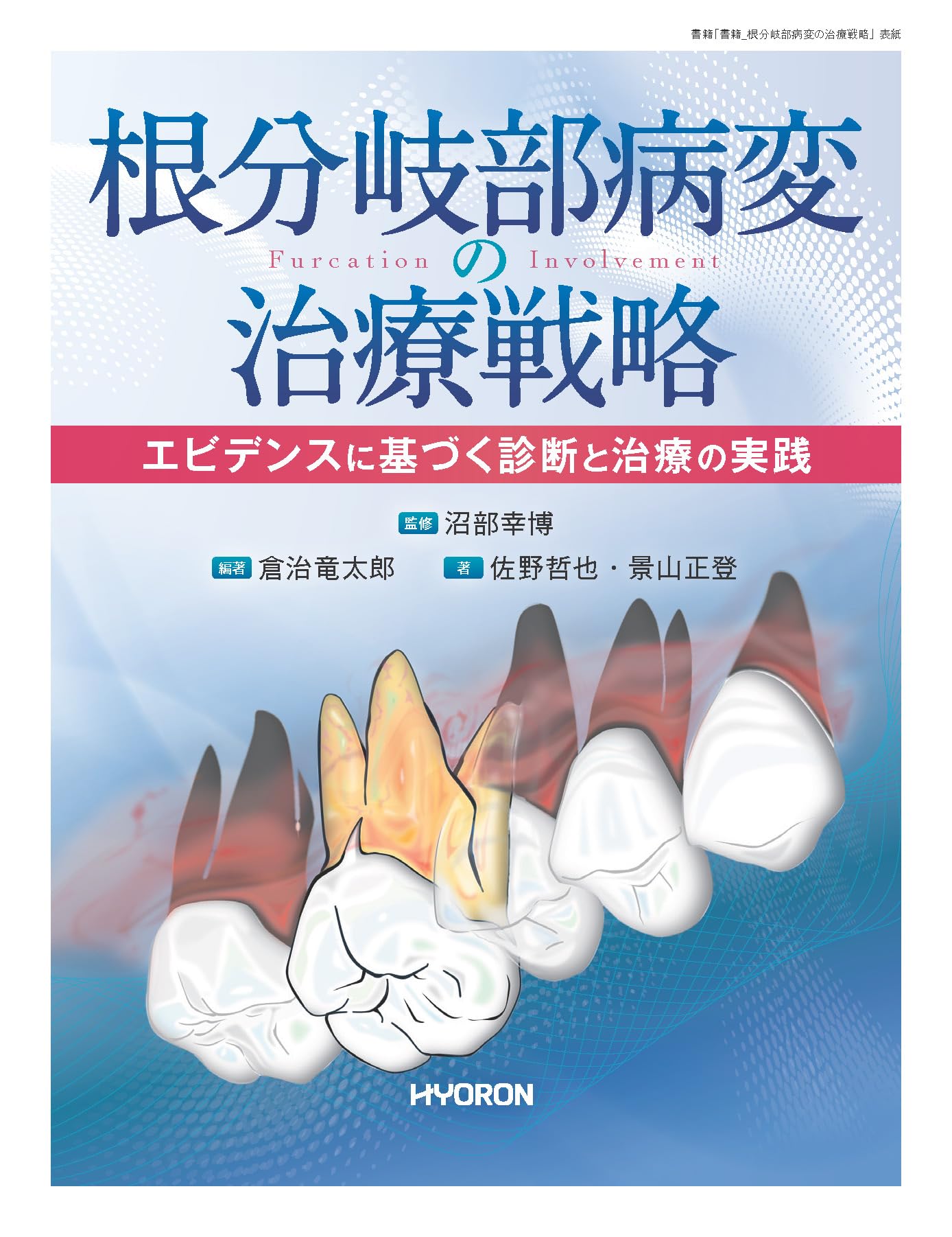 根分岐部病変アトラス　歯科　本 Amazon.co.jp: 根分岐部病変の治療戦略―エビデンスに基づく診断と治療