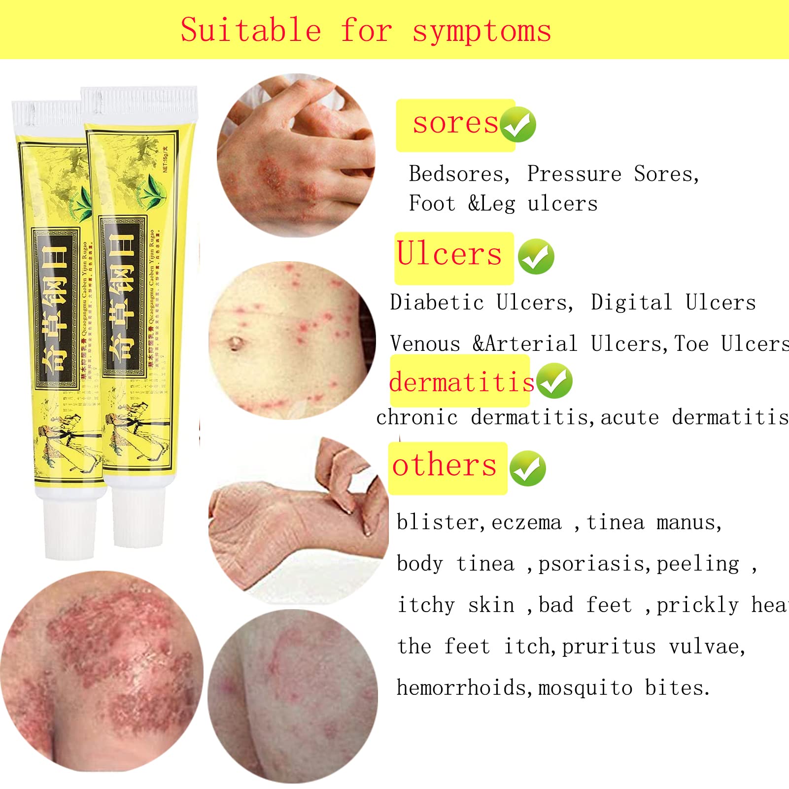 5pcs Lot Chinese Herbal Eczema, Psoriasis Cream,Eczema Cream Natural