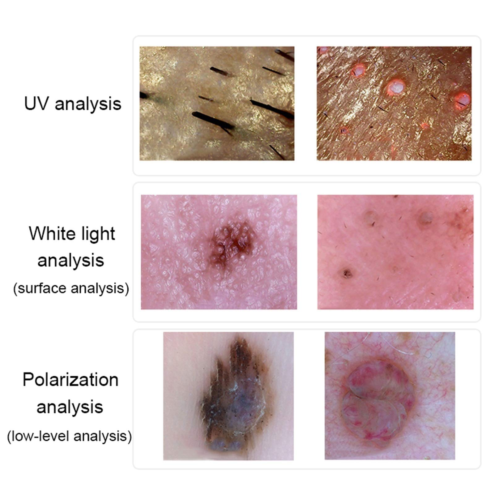 Microscopio Digital, Microscopio Digital, analizador de Piel 100x USB o Zoom inalámbrico, análisis luz polarizada UV LED