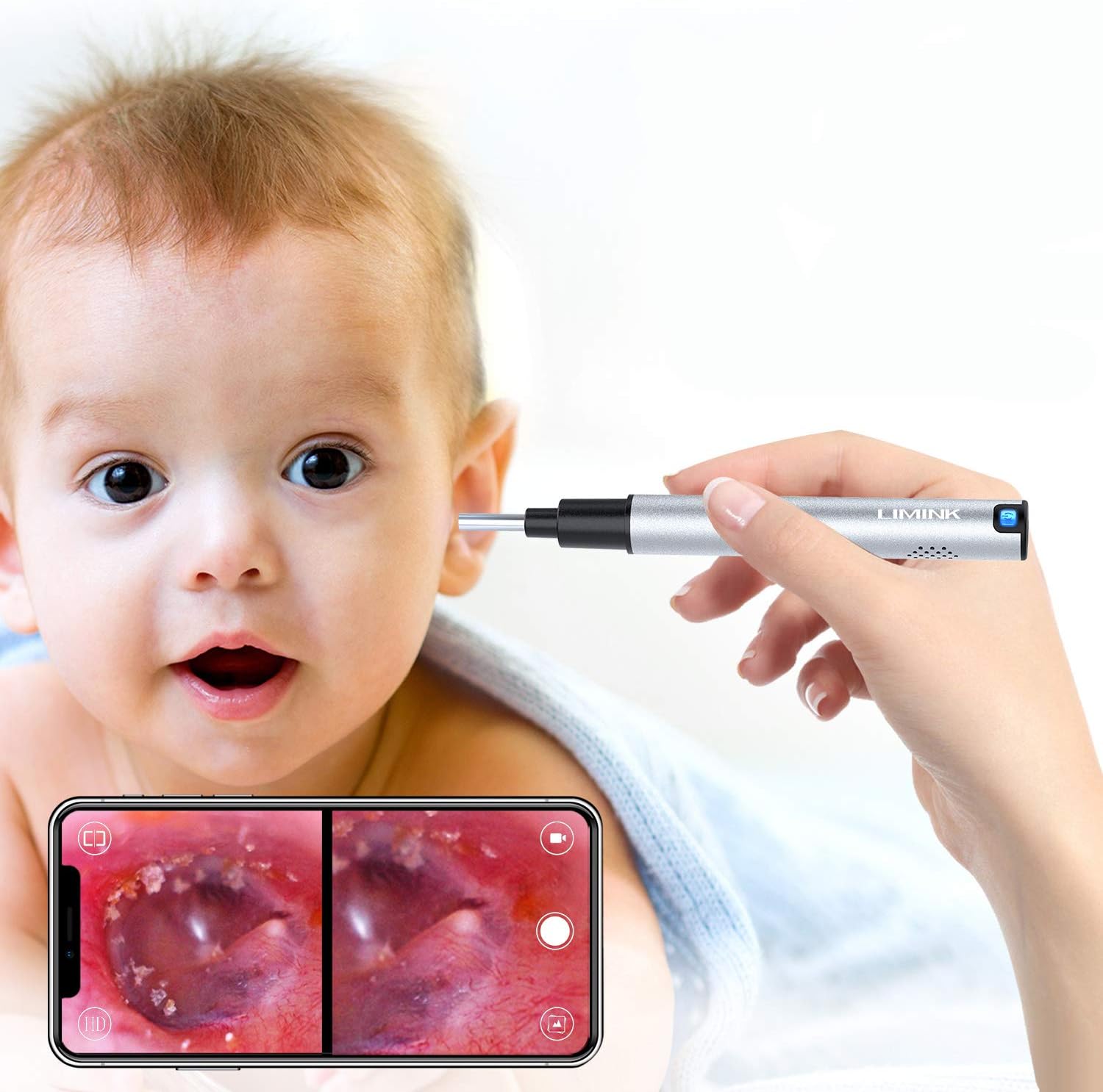 Ear Camera, LIMINK Wireless Otoscope Ear Endoscope Scope for Android & iOS Smartphones, Tablets (Sliver)