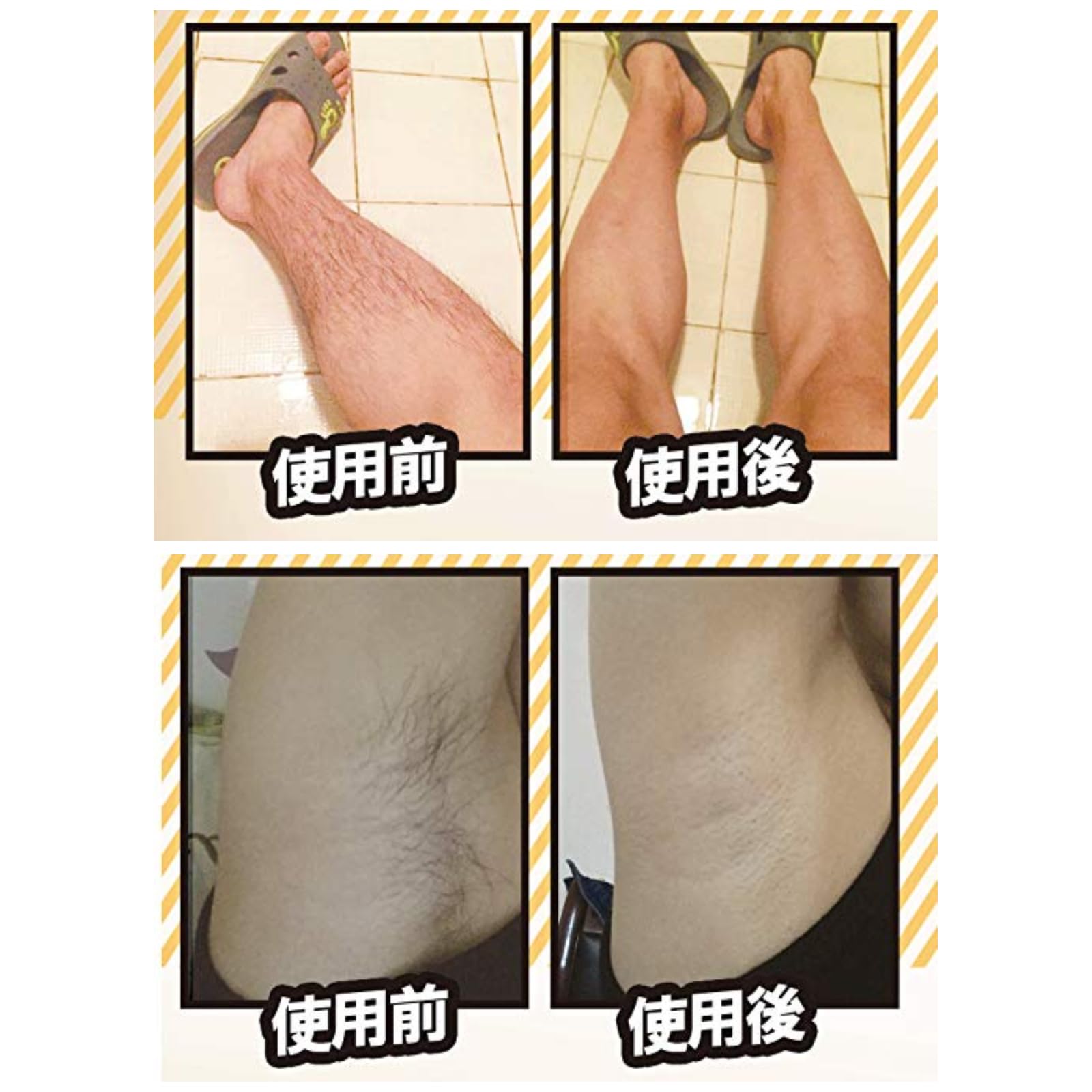 Amazon.co.jp: 男女兼用！簡単！時短！痛くない！なのにしっかり除毛の