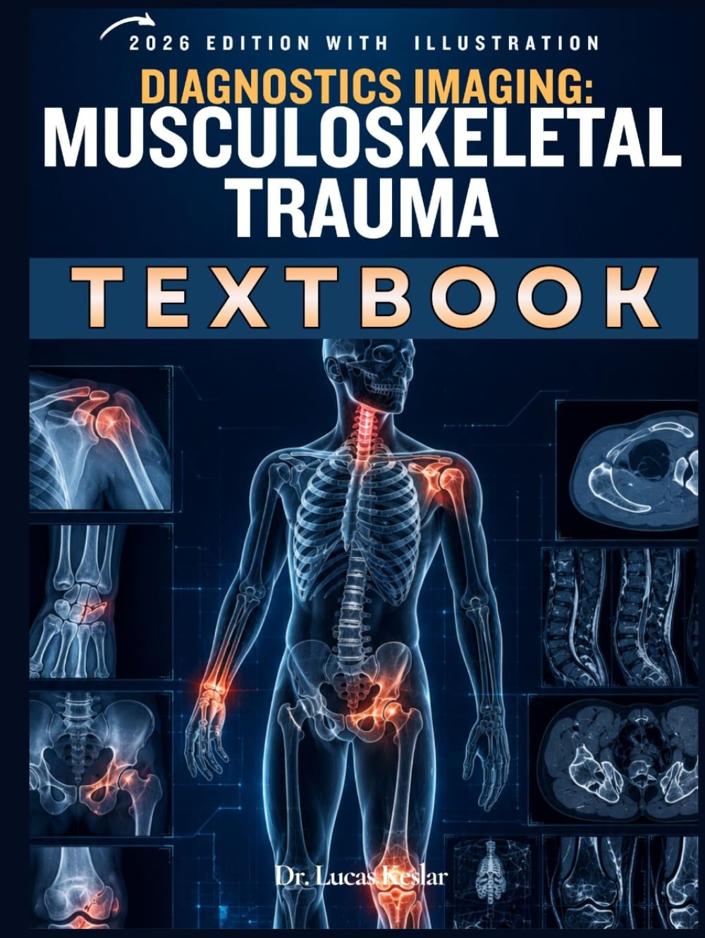 Diagnostic Imaging: Musculoskeletal Trauma: A Practical Clinical Guide to X-Ray, CT, MRI, Fracture Interpretation, Emergency Reporting, Case Review, and Board-Style Questions