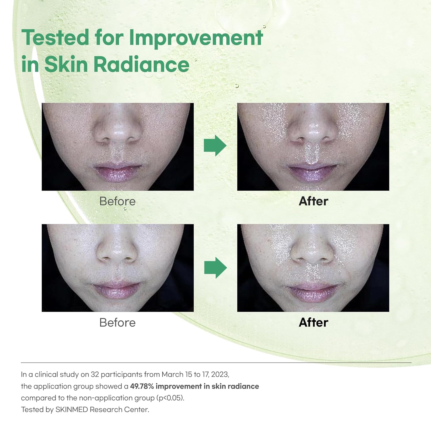 Calming Repair Cica Oil Serum, Centella Essence, 5% Moisture Oil, 1.01 fl. oz - Image 4