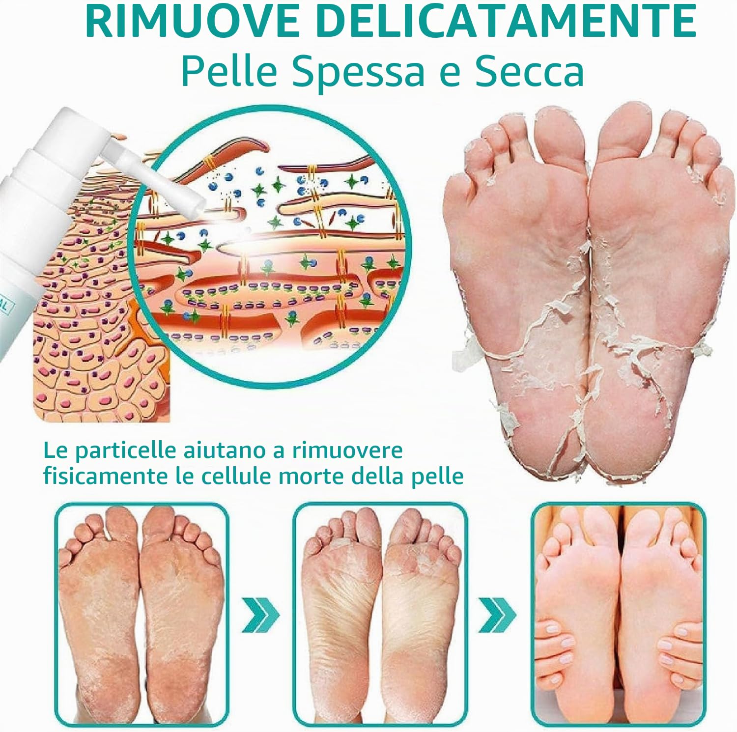 Spray extra forte per rimuovere i calli: spray rimuovi calli per piedi e tallone, olio spray per pelle morta