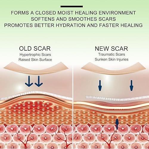 Miniatura 3 de Hojas de cicatriz de silicona, hojas de cicatriz de gel de silicona transparente, cinta invisible para cicatrices (rollo de 1.6 x 120 pulgadas,