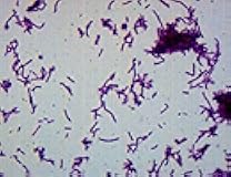 EISCO Bacillus Smear, Gram Negative Stain - Prepared Microscope Slide - 75 x 25mm - Biology & Microscopy