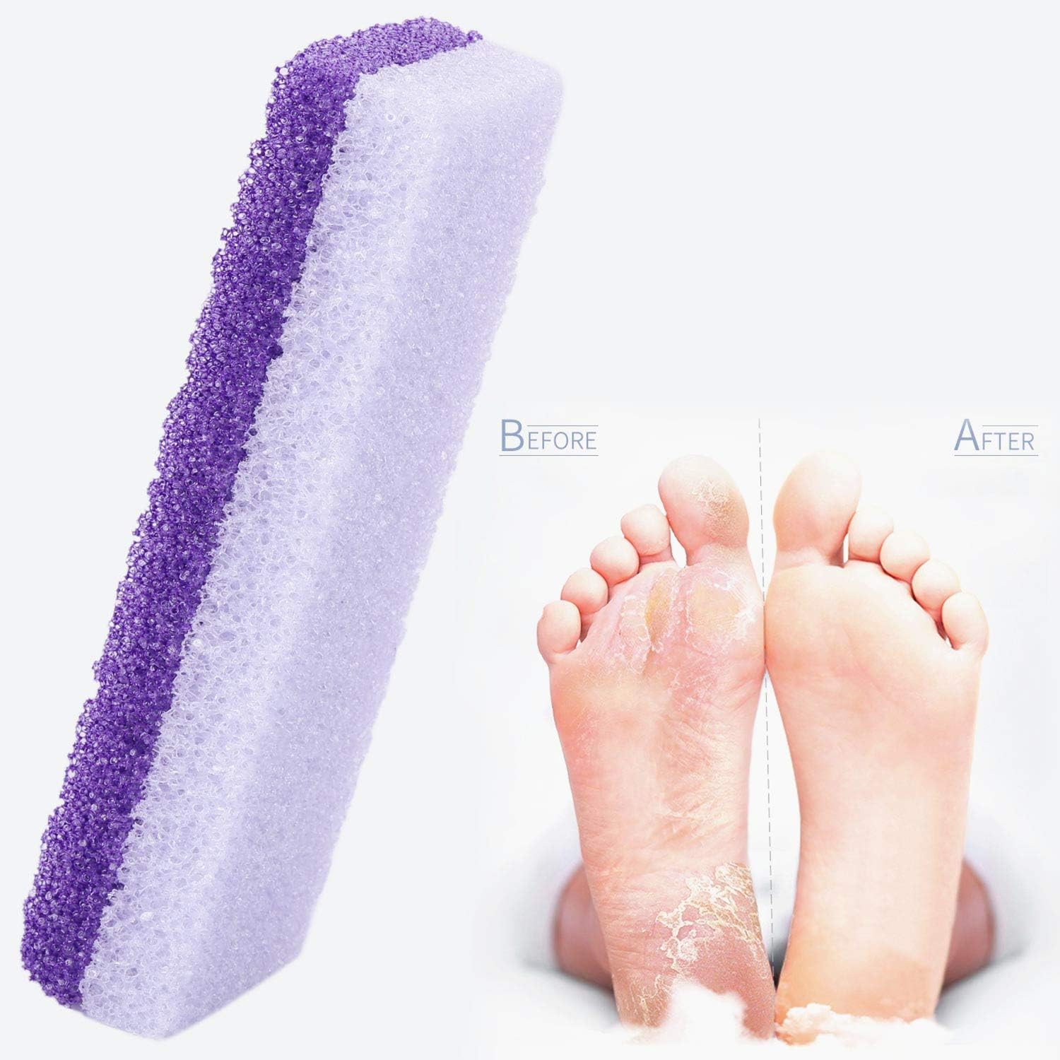6 Pieces Foot Pumice Stone 2 in 1 Double Sided Foot Scrubbers Pedicure Callus Remover Purple Pumice Sponge Heel Buffer for Feet Dead Skin