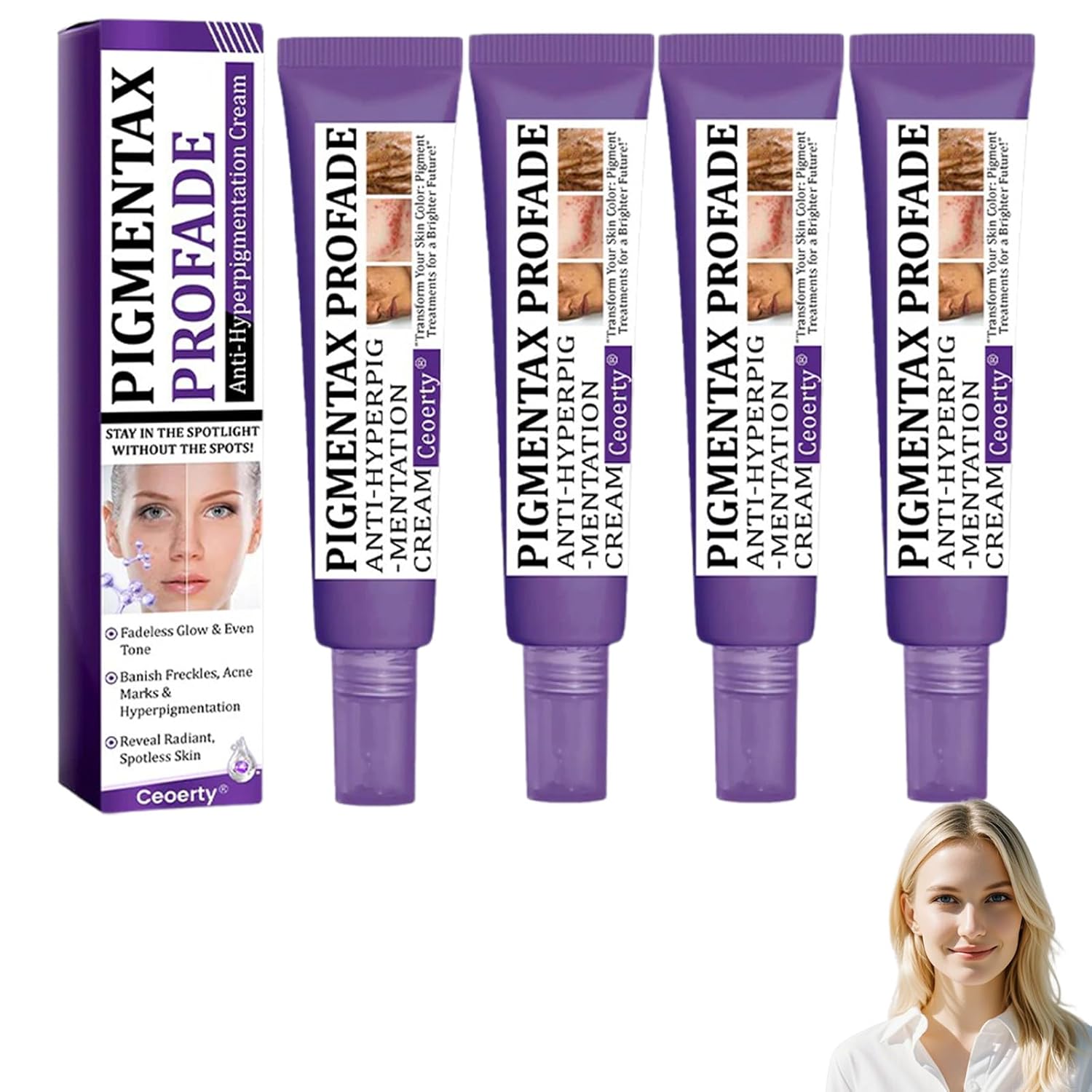 PigmentaX ProFade Cream – Hyperpigmentation Treatment for Even Skin Tone (3PCS)