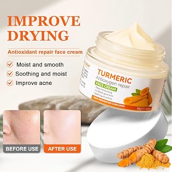 Turmeric Face Cream, Brightening Face Cream for Radiant & Glowing Skin, Vitamin C Moisturiser, Dark Spot Corrector Remover, Natural Turmeric Cream Skin Care, Anti Aging, Moisturizing, Erase Fine Lines