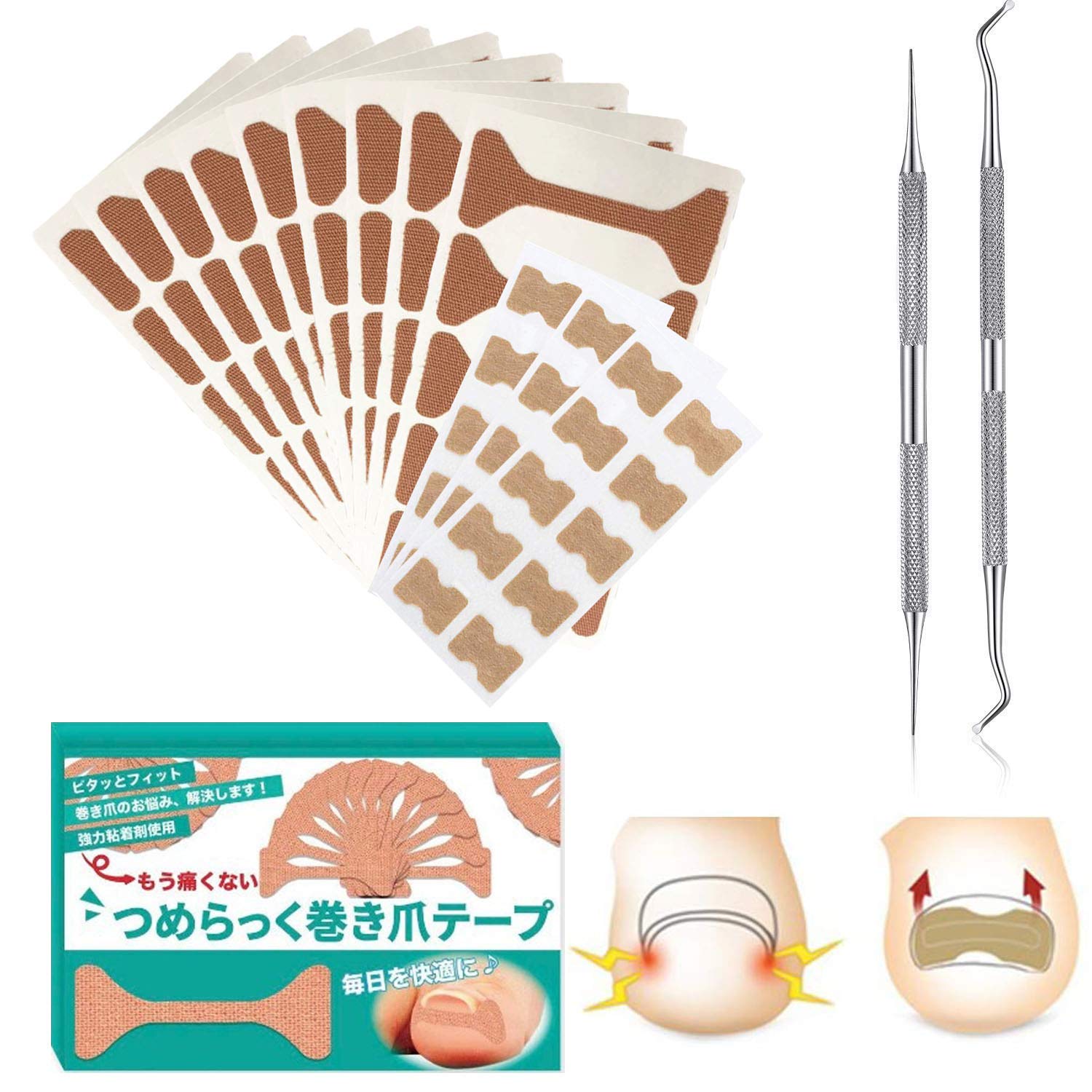 Buy Ingrown Toenail Tool, Ingrown Toenail Correction PatchIngrown