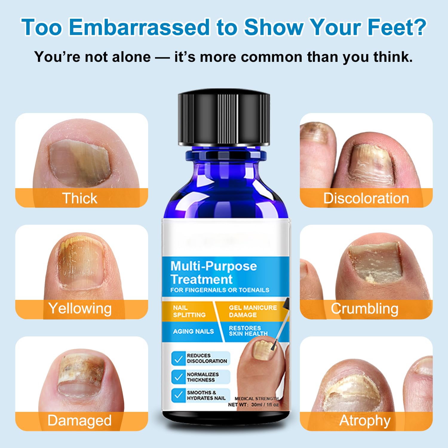 Nail Fungus Treatment – Antifungal Nail Solution for Thick, Discolored Toe Nail Fungus Treatment Extra Strength with Precision Brush – 1 fl oz — view 2
