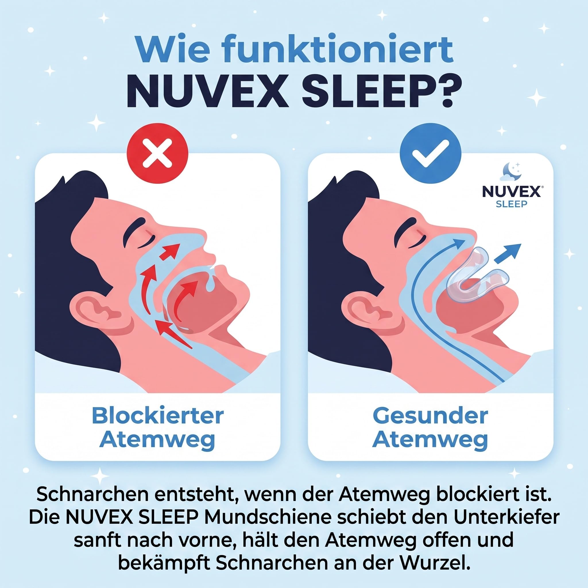 Nuvex Sleep – Anti-Schnarch-Schiene, 3er-Pack 10 Stufen Anpassbar
