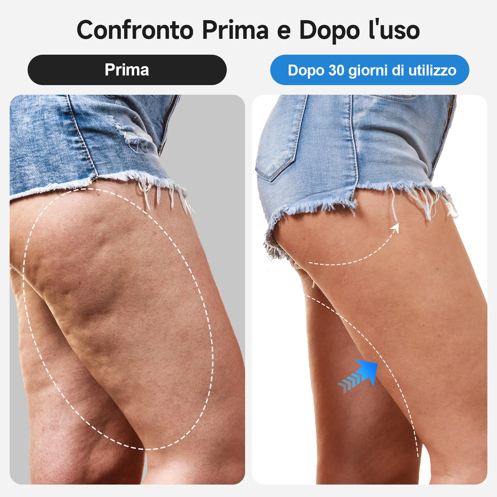 Coppette 3 in 1 anticellulite | Coppette, EMS, luce rossa. Addome/gambe/glutei, 3–5 min/giorno, pelle soda