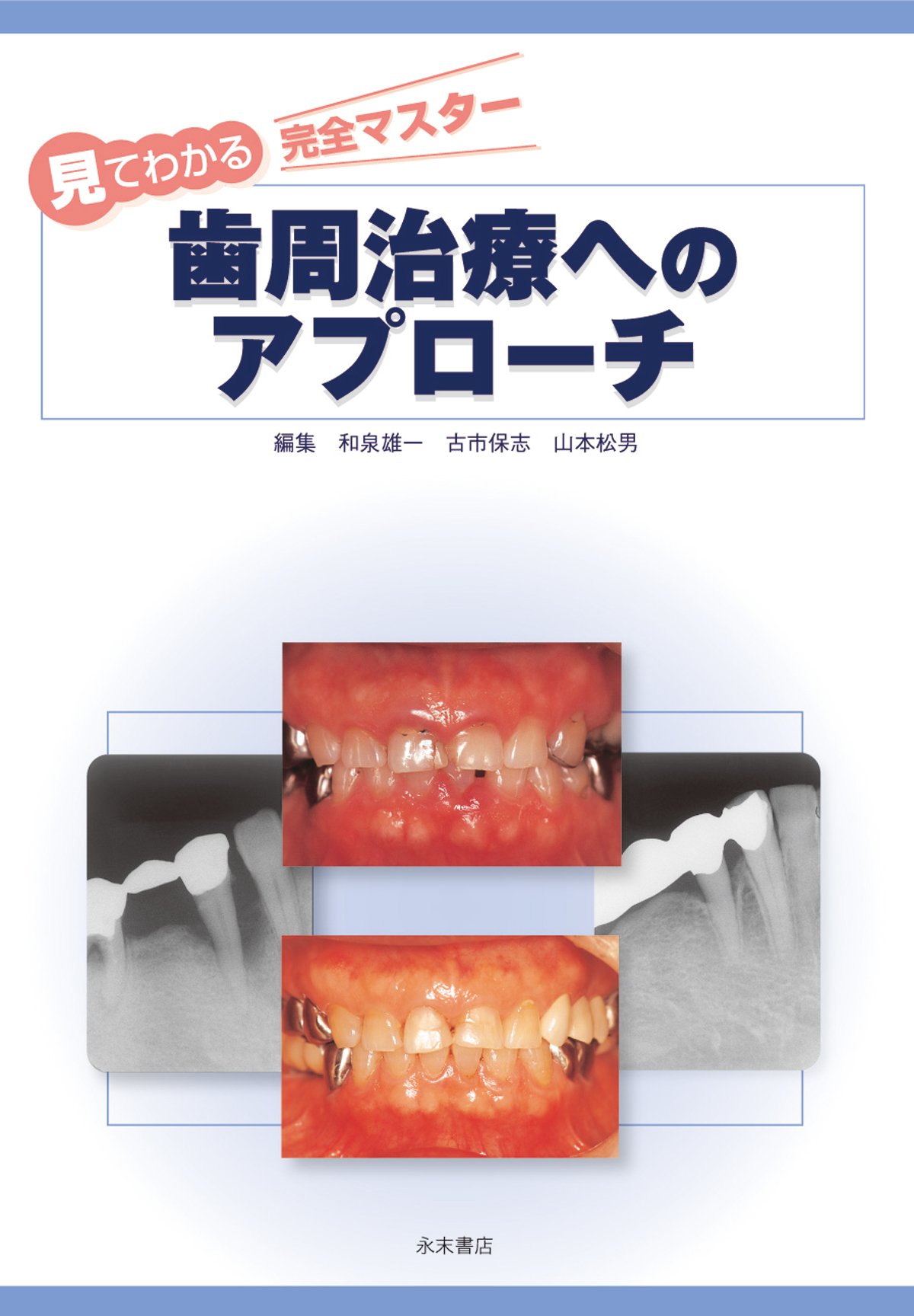 歯周治療へのアプロ-チ 見てわかる完全マスタ-/永末書店/和泉雄一（大型本） 歯周治療へのアプロ-チ 見てわかる完全マスタ-/永末書店/和泉