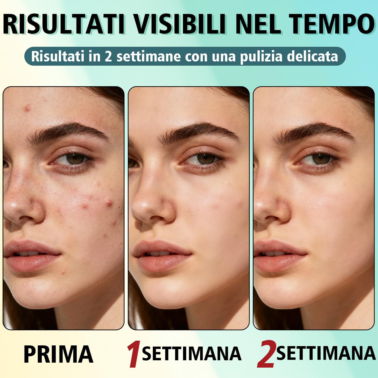 Crema Brufoli Viso, Crema Acne Potentissima, Cura per Brufoli e Imperfezioni, Riduce Subito Acne e Brufoli, Punti Neri e Rossori, Adatta a Tutti i Tipi di Pelle e Età,per la Pelle di Viso e Corpo