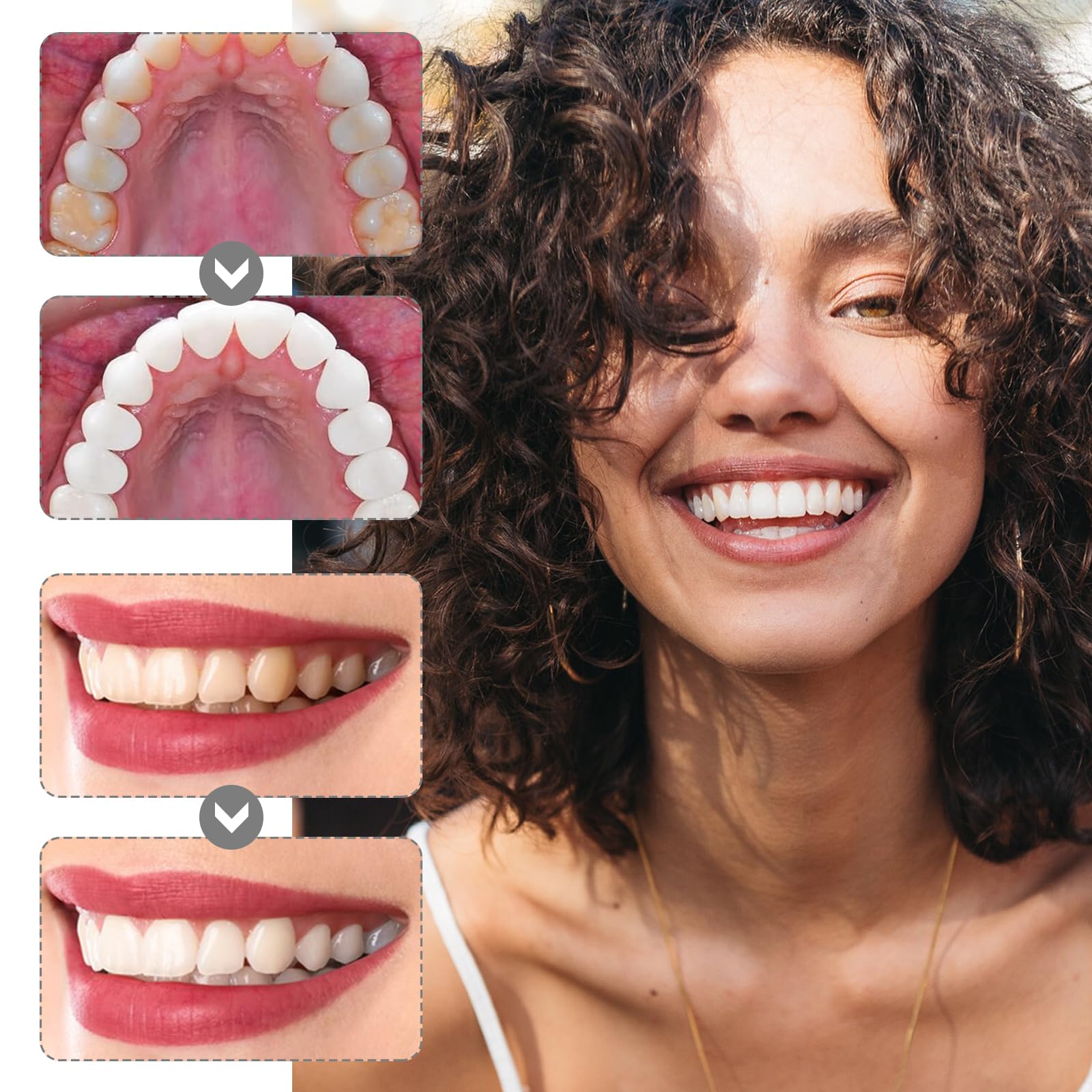 Papel De Lija Dental Tiras De Lijado Dental Tira De Pulido Dental Dientes Abrasivos 5 Pcs