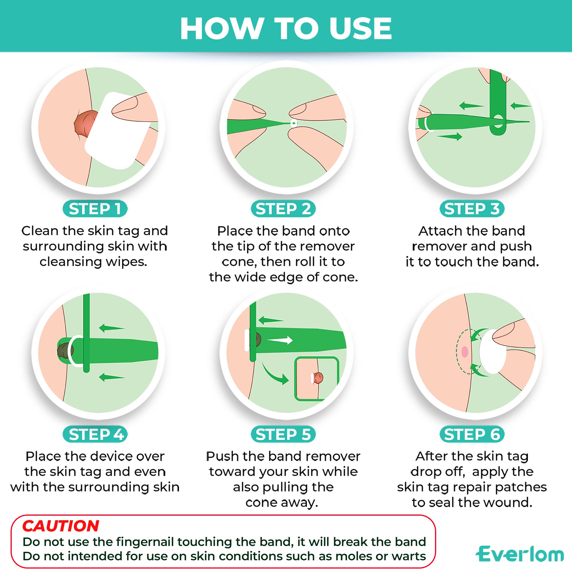 Buy Everlom 2 in 1 Skin Tag Remover, Fast and Easy Skin Tag Remover, Safe for Small to Large