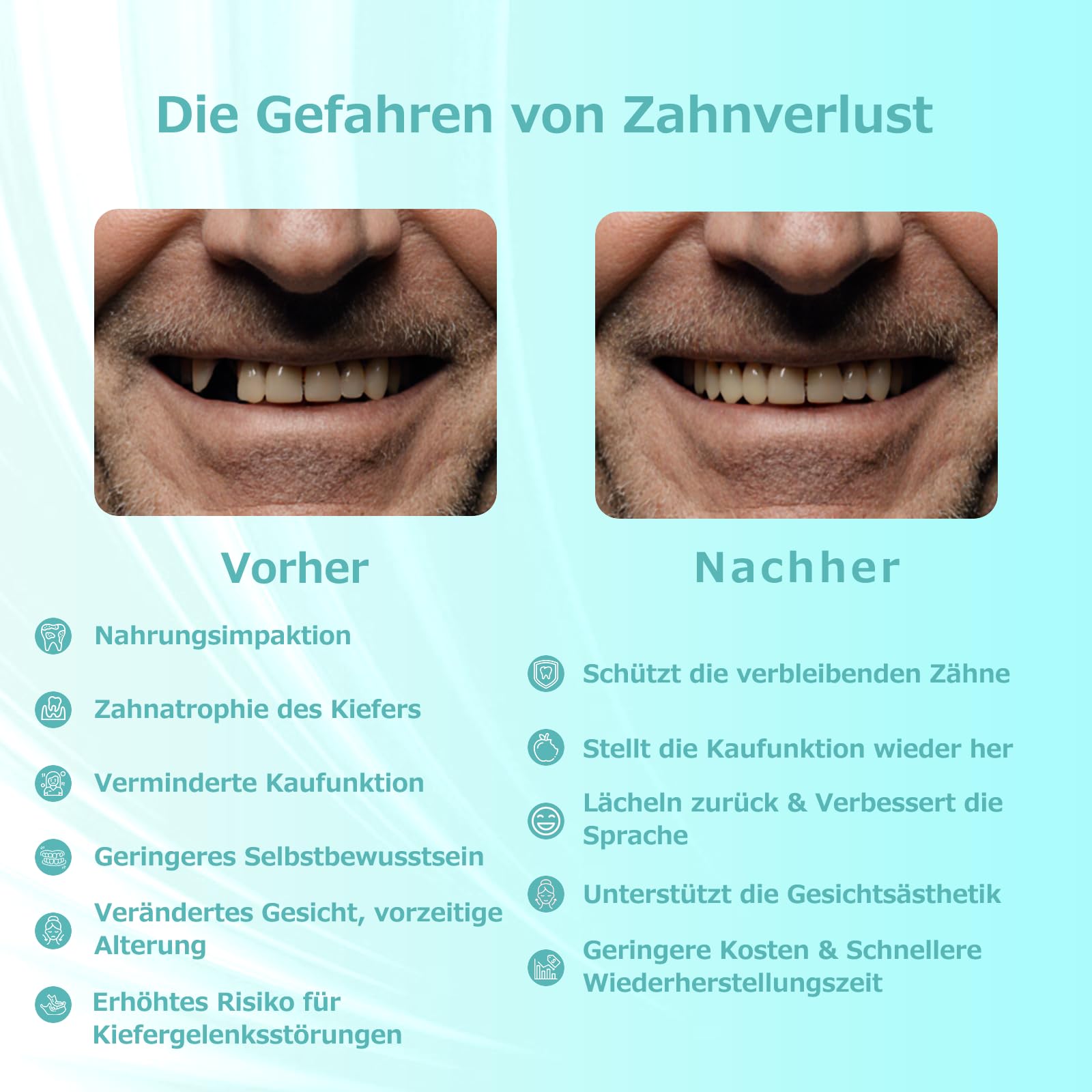 Maßgefertigte Teilprothese für Zahnlücken – Herausnehmbarer Provisorischer Zahnersatz für Frauen Männer, Zahnprothese mit perfektem Sitz. Einfache Anwendung für Ihr perfektes Lächeln zu Hause (1 Zahn)