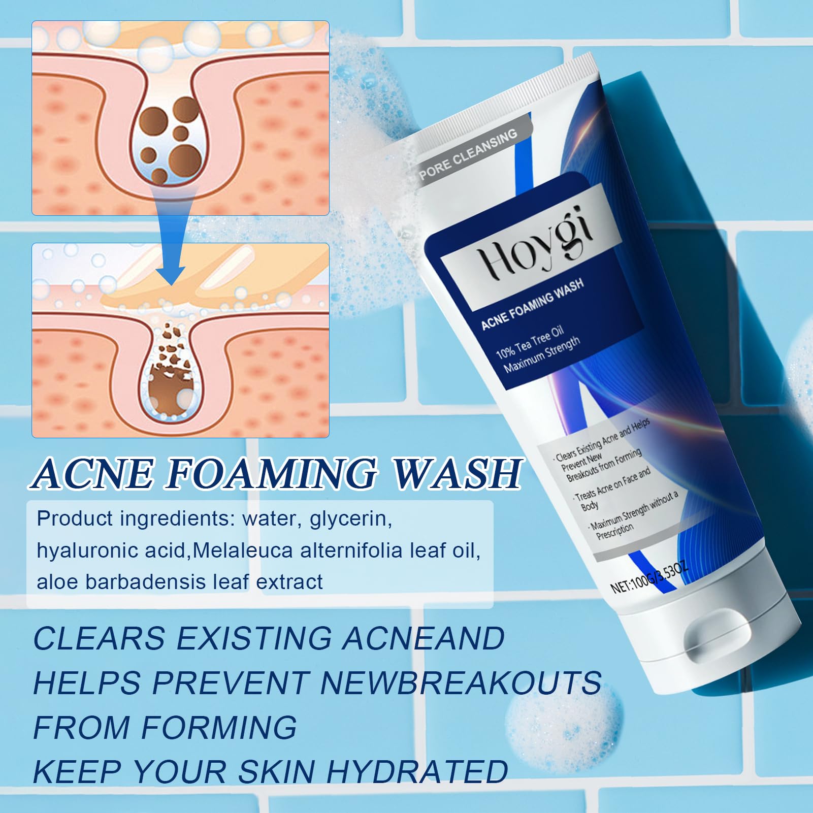 Acne Foaming Wash, pianka do głębokiego oczyszczania porów | Łagodny codzienny środek do mycia twarzy do głębokiego oczyszczania porów, przeciwpryszczowy płyn, do oczyszczania twarzy z
