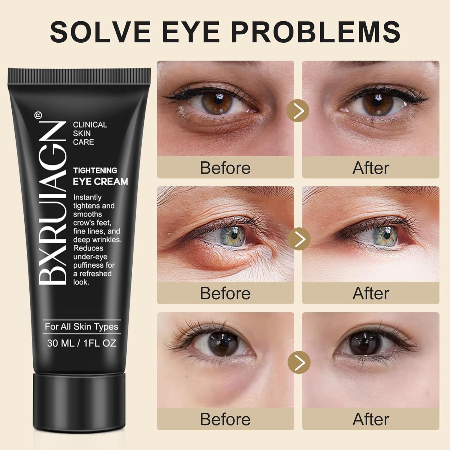 Instant Eye Tightener - Quickly Reduces Dark Circles, Eye Bags, Puffiness and wrinkles, Locks in Moisture - Image 3