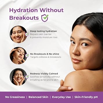 AcMist Face Moisturizing Cream Gel for Acne Prone & Oily Skin Enriched with Vitamin E, Aloe Vera & Squalane Oil-free, Non Comedogenic & Quick Absorbing Formulation For All Skin Types, 50gm