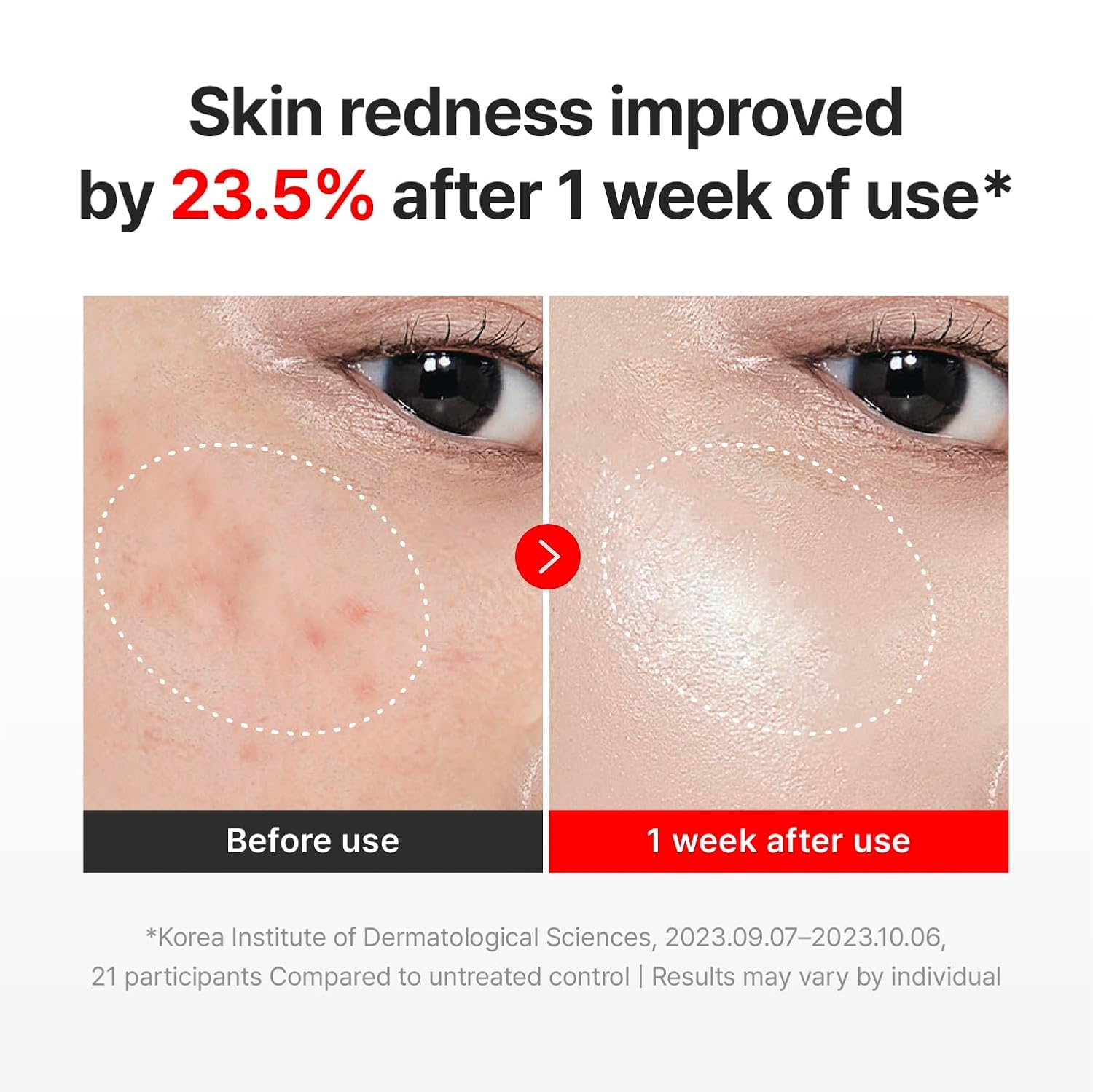 Centellian24 Madeca Cream Time Reverse