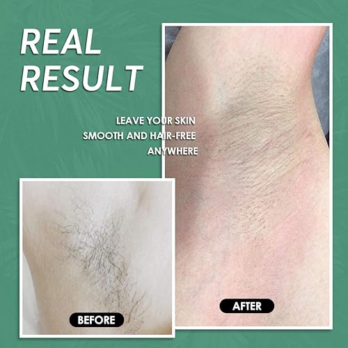 Miniatura 5 de Maxpearl Cuentas de cera para depilación, bolsa de repuesto de granos de cera dura de 2.5 libras para bikini brasileño, cara, cejas, axilas, brazos,