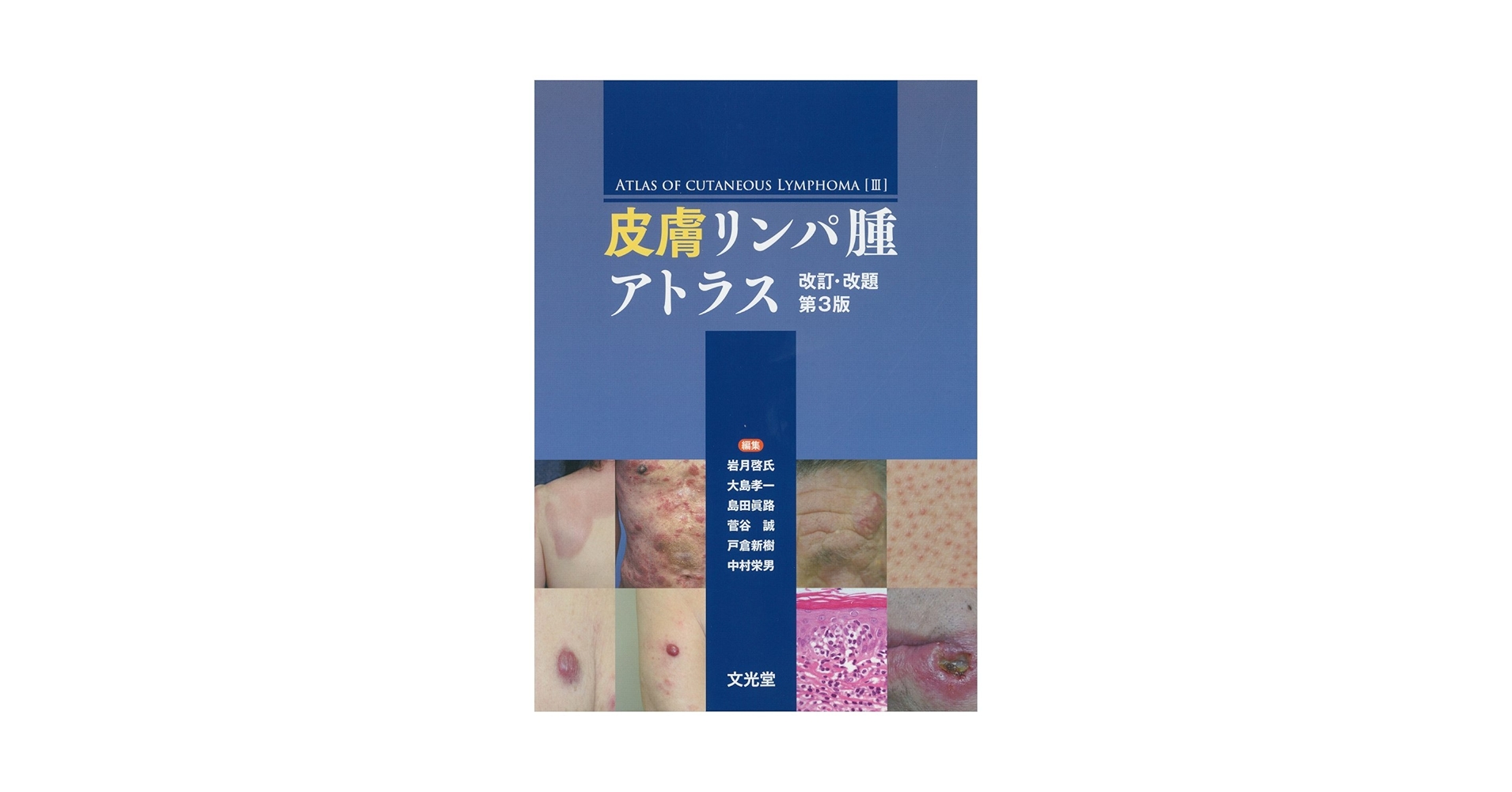 皮膚リンパ腫アトラス | 岩月 啓氏, 大島 孝一, 島田 眞路, 菅谷