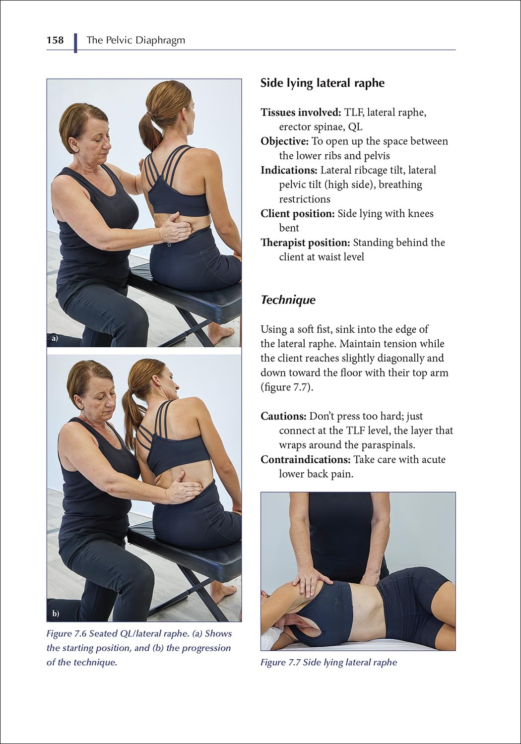 The Pelvic Diaphragm: Treating Pain and Dysfunction from a Global Anatomical Perspective