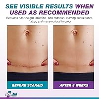 Vista 4 de Láminas de gel de silicona de grado profesional clínicamente probadas, reutilizables, lavables y personalizables para cicatrices más suaves