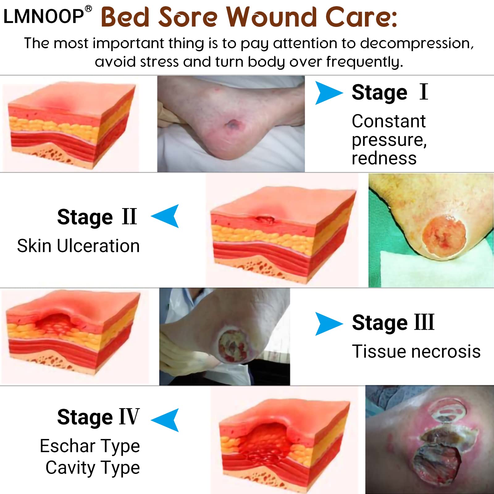Weeping Wounds: A Comprehensive Guide For Faster Healing - iiri1qb
