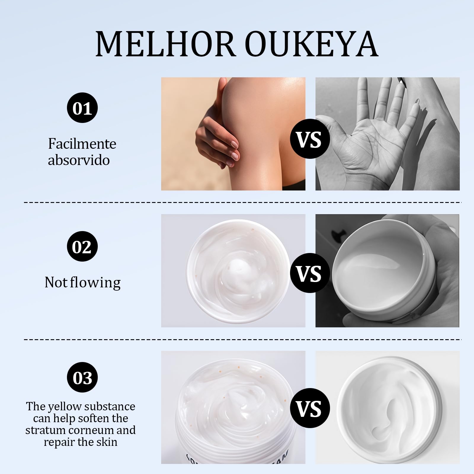 Crema Urea 40% per Piedi,Talloni,Mani e Gomiti,150g Crema Riparatrice per Pelle Secca e Screpolata,Anti Calli,Idratante Intensa per Talloni Screpolati e Piedi Molto Secchi