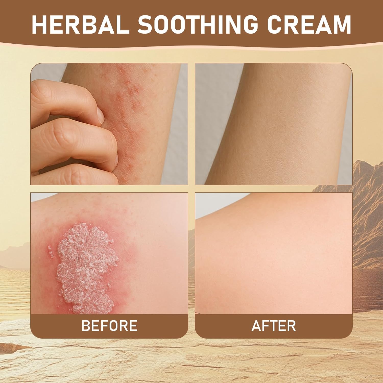 All Natural Herbal Soothing Cream, Chinese-Herbal Relief Balm for Body Care, Ointment for Relieves Dry Skin, Soothing Skin | Relieves Itching, Rich in Menthol, Calendula & Dendrobium