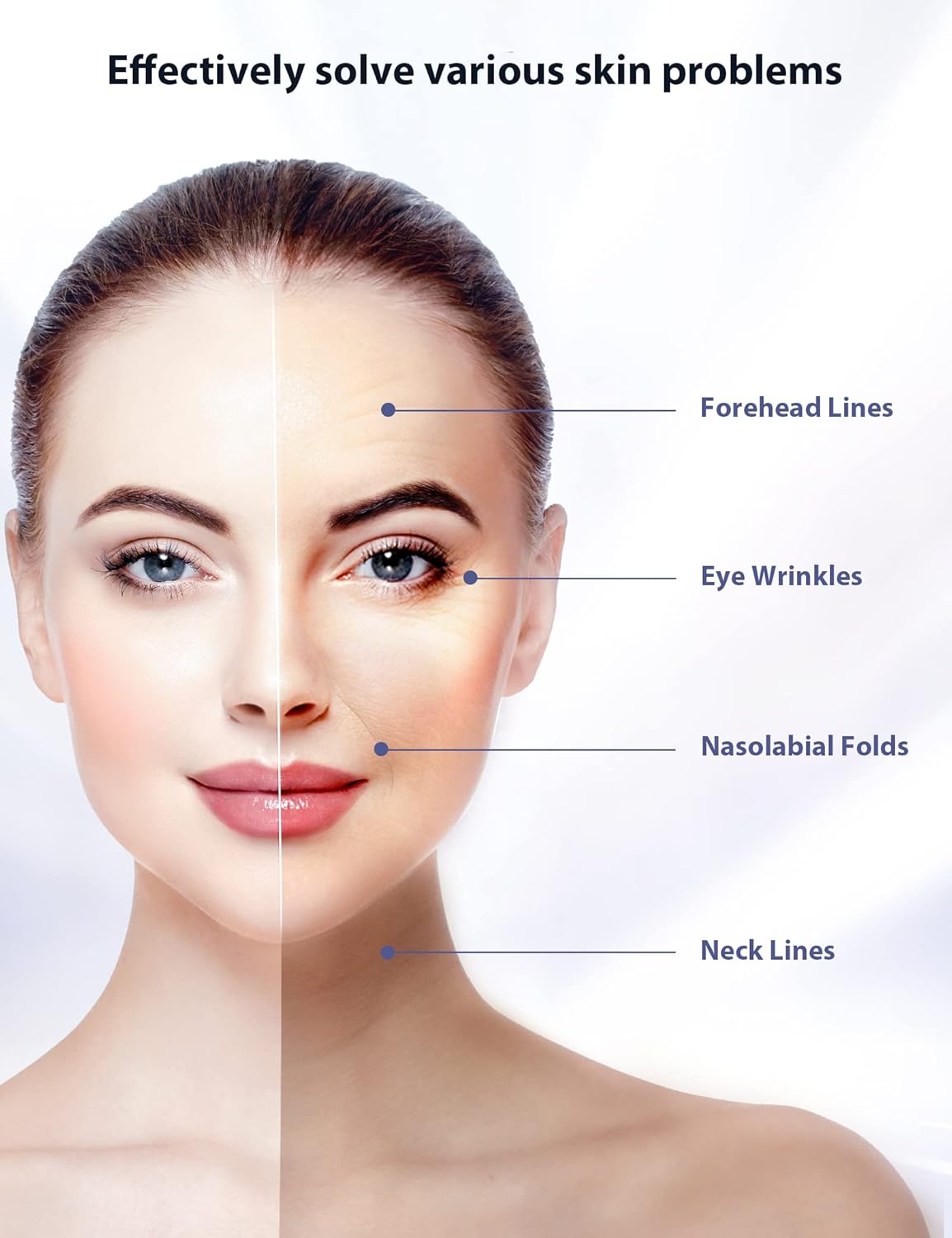 Diagram of ANLAN RF EMS Facial and Neck Device components