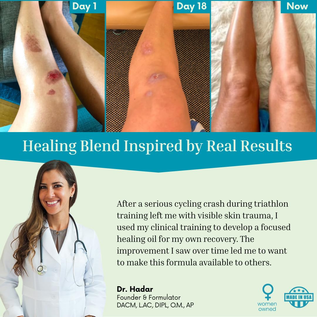 The Vibrant Glow, Luxury Beautifying Oil for Scars & Stretch Marks, Brightening & Smoothening, Hydrating Face & Body, Pure Oil Blend with Vitamin E, Rosehip & Argan, Vegan, Dermatologist Tested, 2 oz