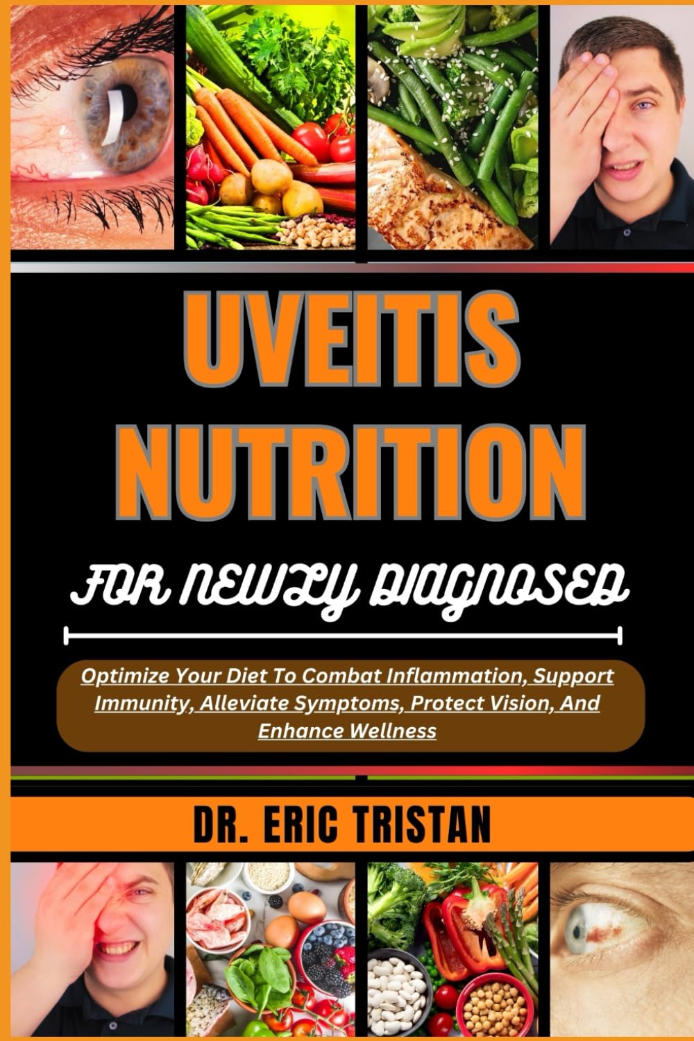 UVEITIS NUTRITION FOR NEWLY DIAGNOSED: Optimize Your Diet To Combat Inflammation, Support Immunity, Alleviate Symptoms, Protect Vision, And Enhance Wellness